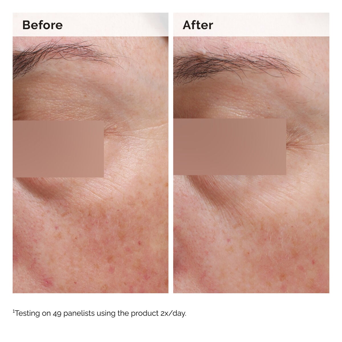 niacinamide-5-face-and-body-emulsion-b9 2024-08-23-ORD-Nia-5pct-Face-Body-B-A-Elasticity-Global-02-1x1.jpg