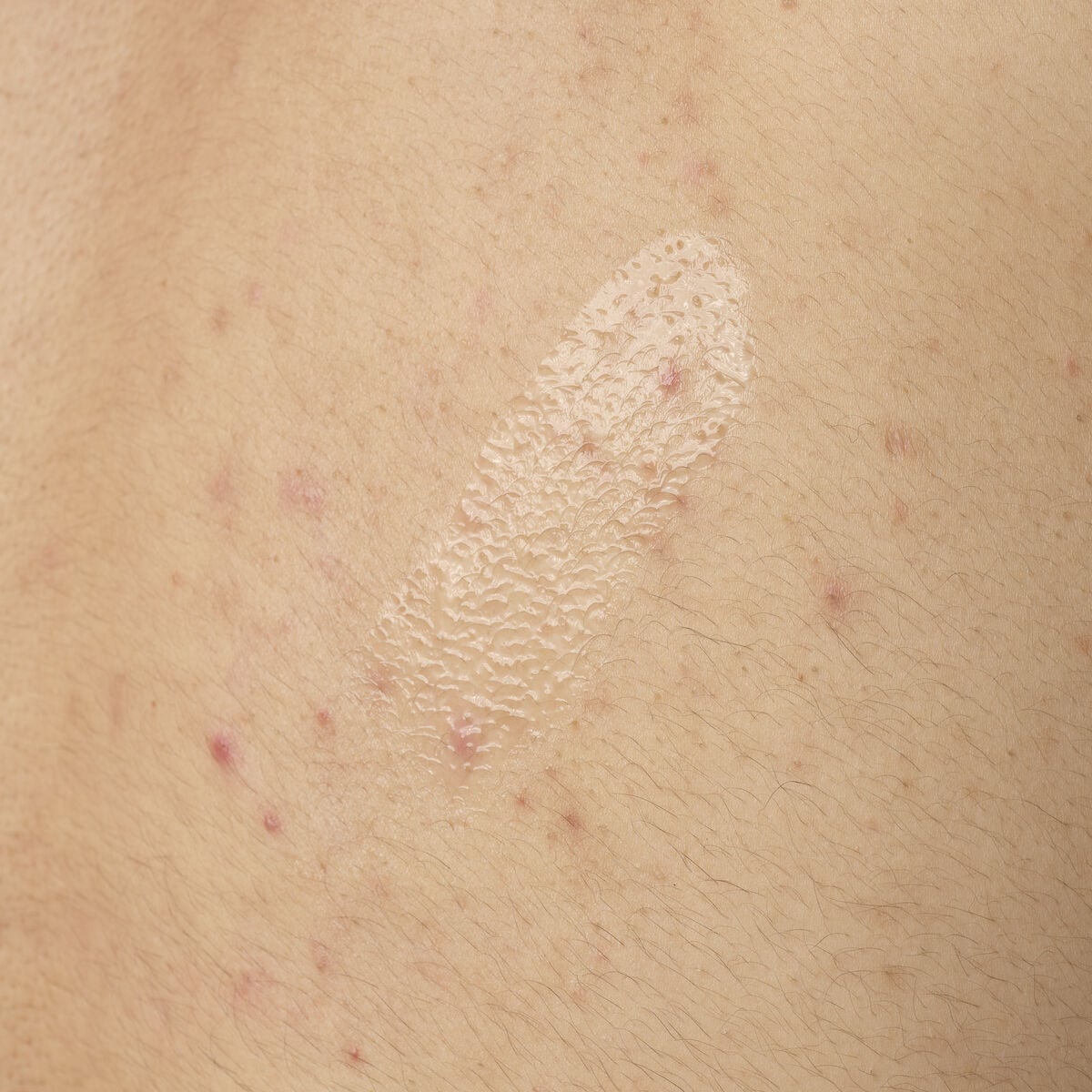 salicylic-acid-0-5-body-serum-k8 ORD-salicylic-acid-05-body-240ml-application.jpg