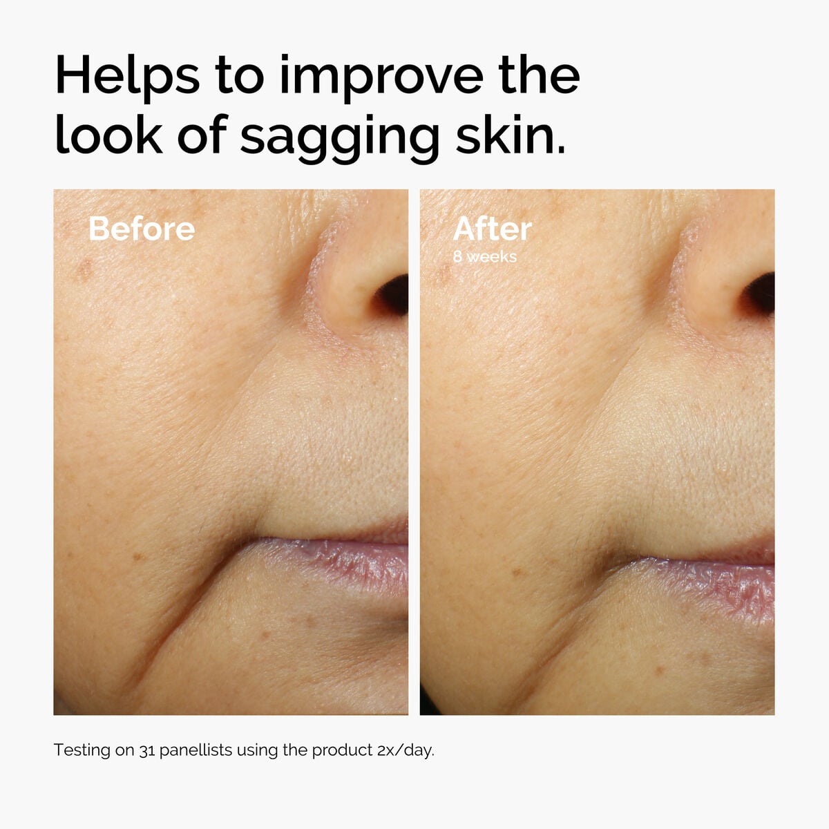 caffeine-3-escin-1-face-serum-n6 ord-caffeine-3pct-escin-1pct-face-serum-before-after-sagging.jpg