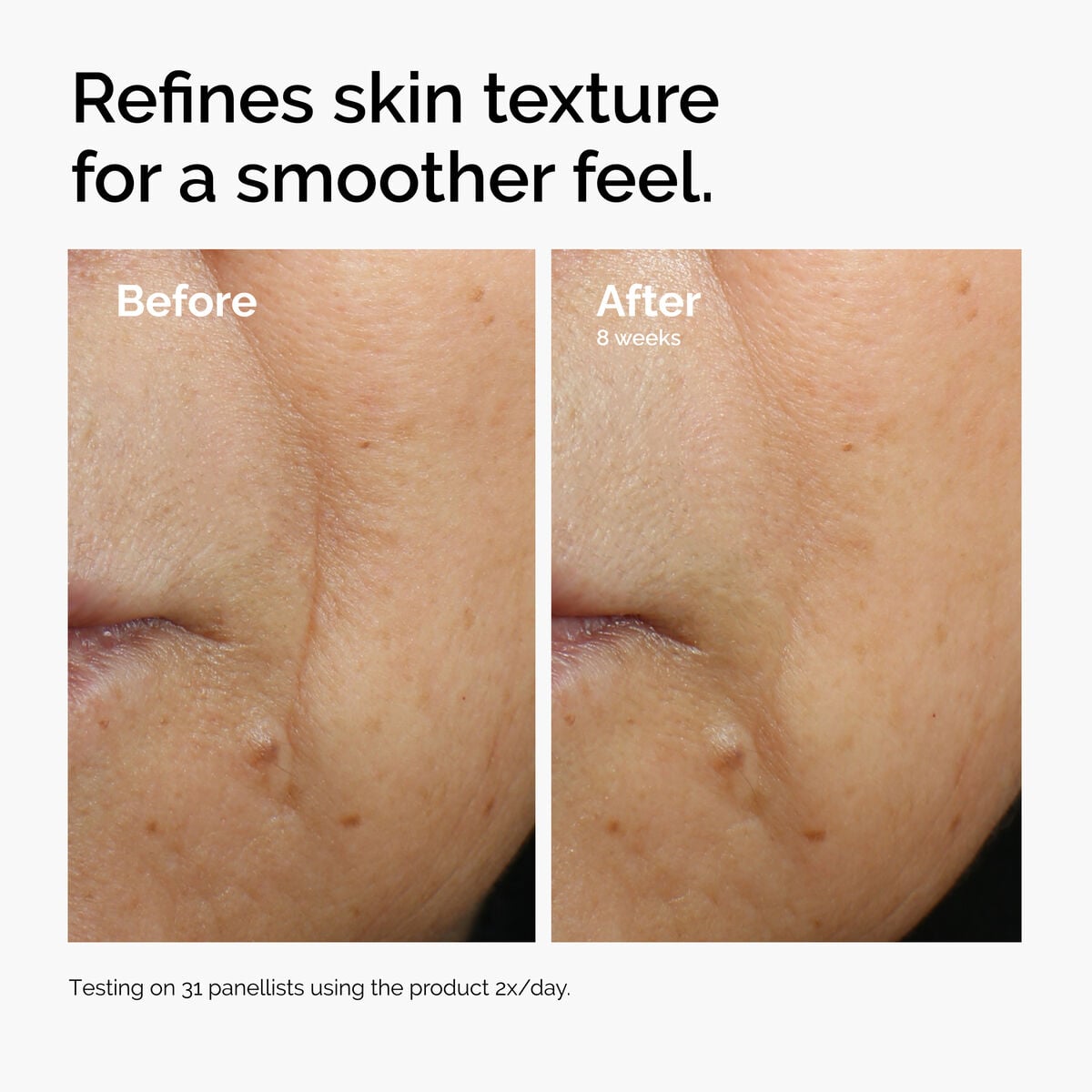 caffeine-3-escin-1-face-serum-n6 ord-caffeine-3pct-escin-1pct-face-serum-before-after-texture.jpg