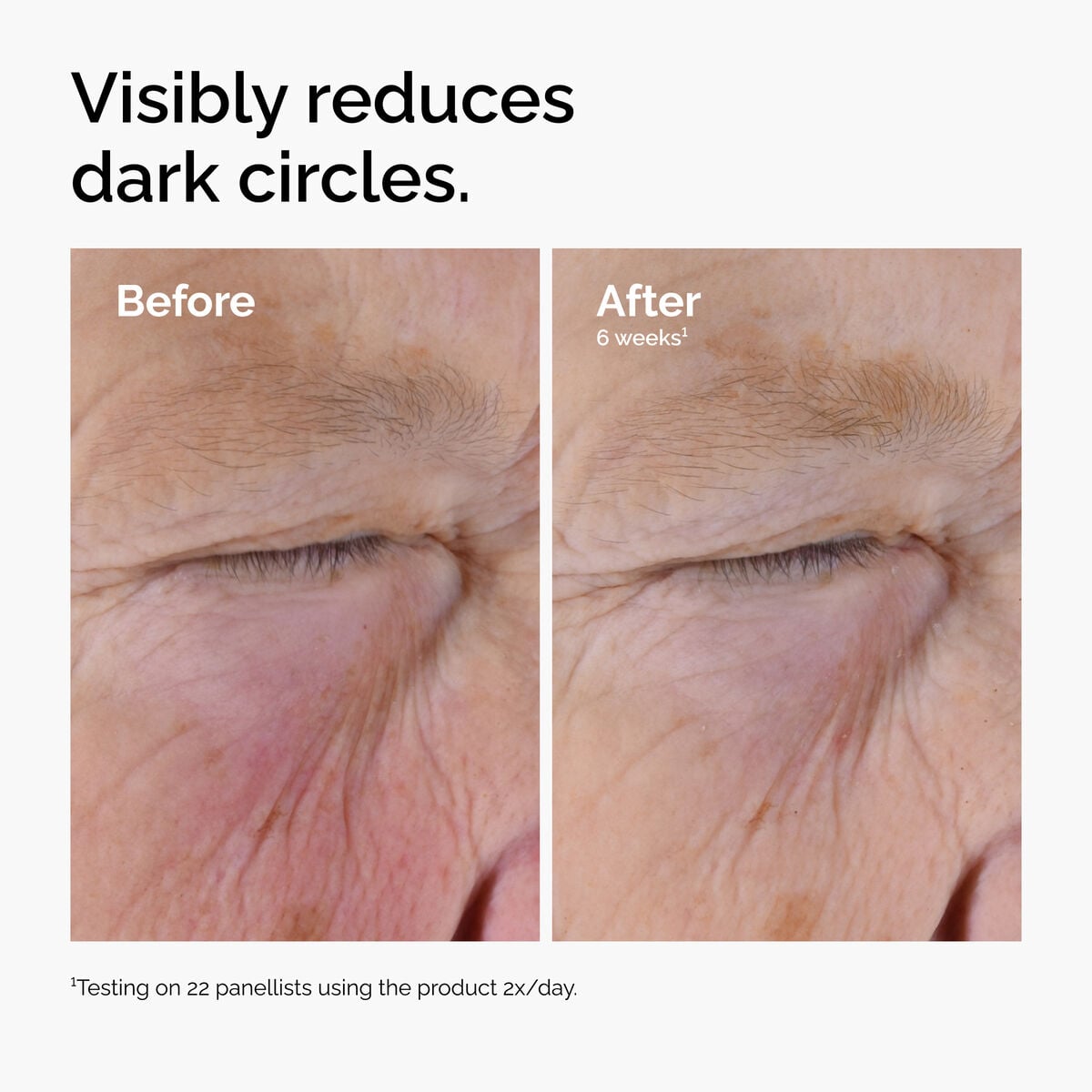 caffeine-solution-5-egcg-eye-serum-w2 ord-caffeine-solution-egcg-dark-circles-before-after.jpg