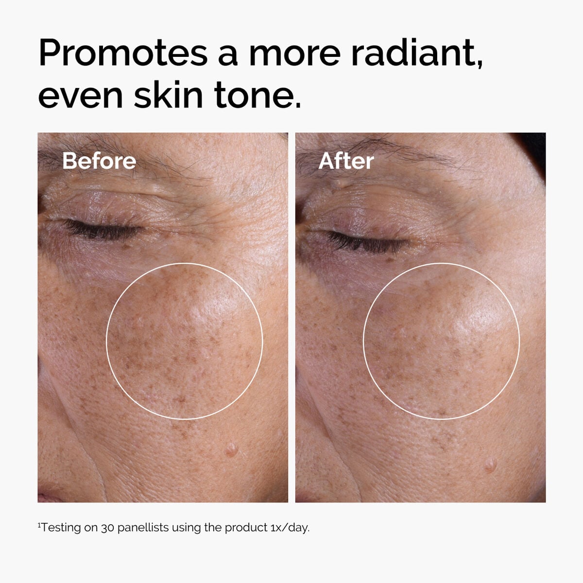 glycolic-acid-7-exfoliating-toner-d2 ord-glycolic-before-after-radiance.jpg