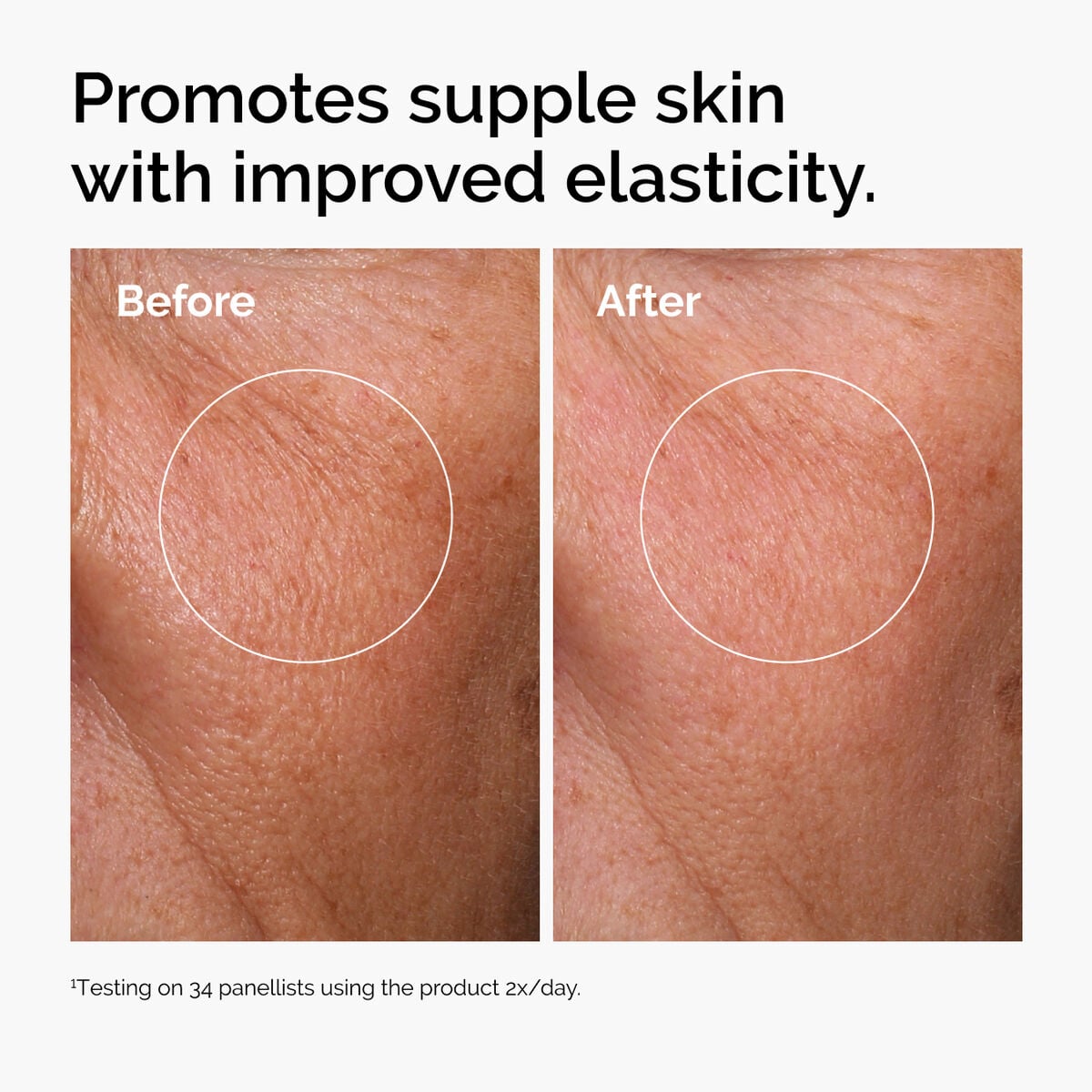 hyaluronic-acid-2-b5-with-ceramides-i8 ord-hyaluronic-acid-2pct-b5-hydrating-serum-before-after-elasticity.jpg