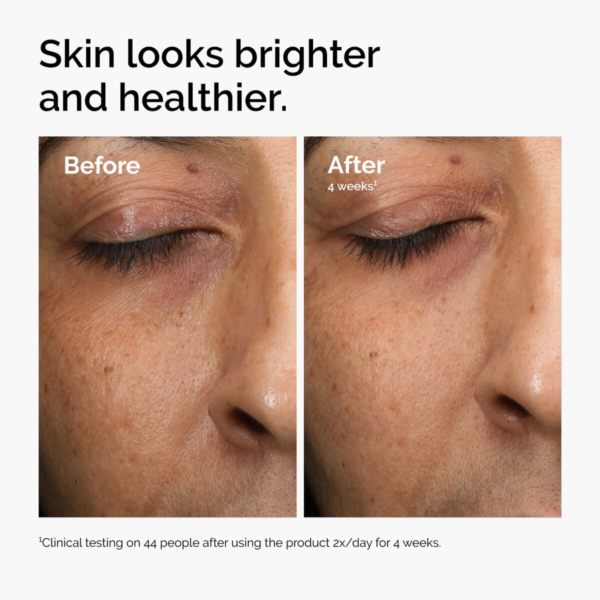 multi-antioxidant-radiance-serum-w0 ord-mars-before-after-healthy.jpg
