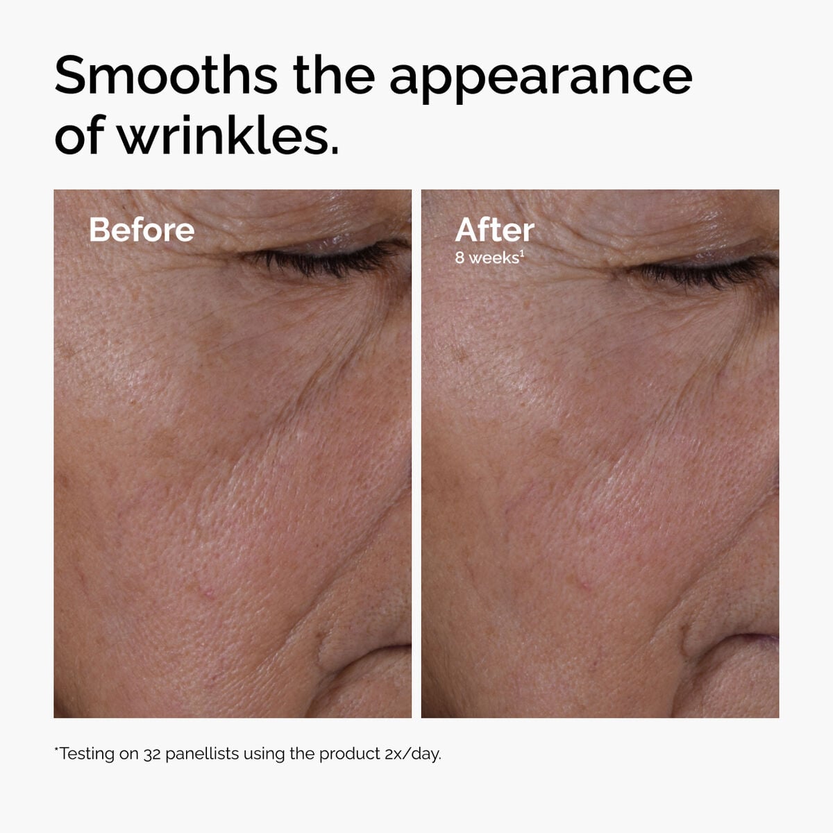 multi-peptide-ha-serum-r9 ord-multi-peptide-ha-serum-wrinkles-before-after.jpg