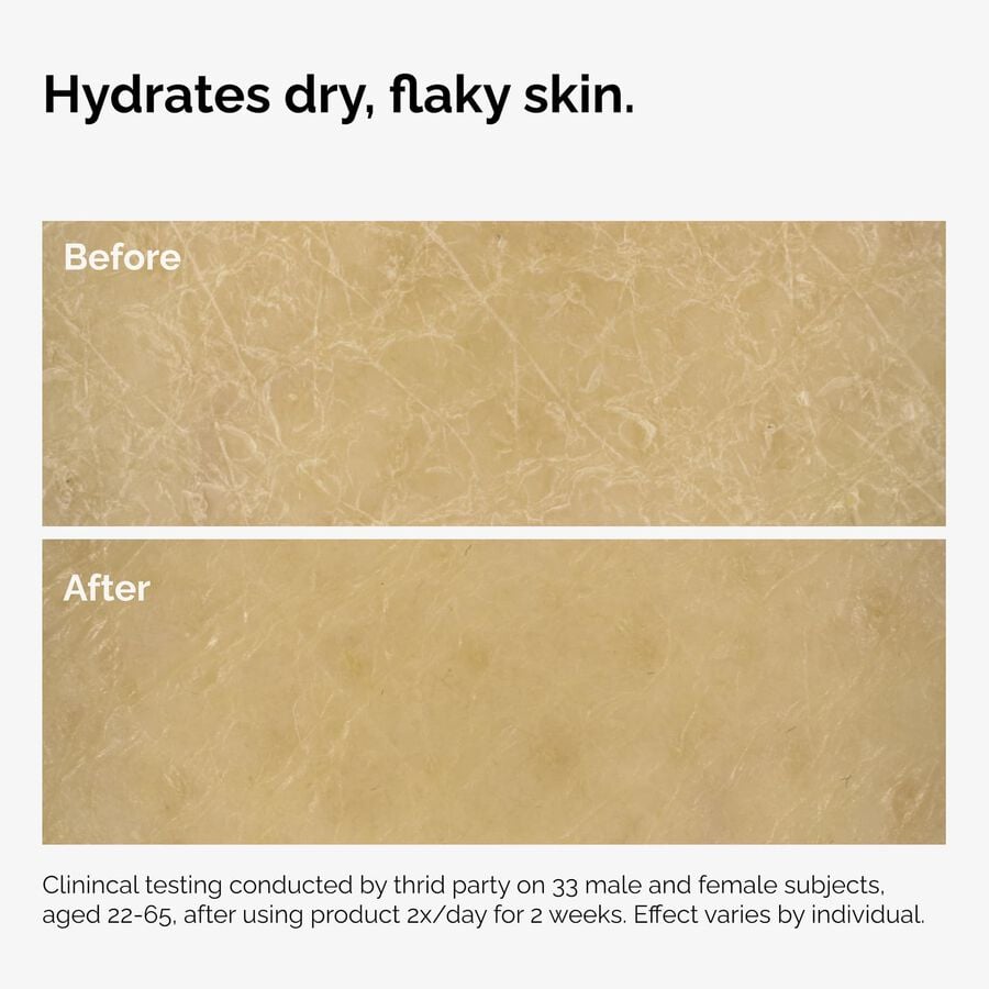 the-body-care-collection-q0 ord-natural-moisturizing-factors-inulin-body-before-after-graphic-02.jpg