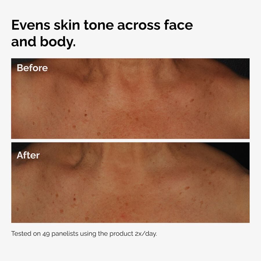 the-body-care-collection-q0 ord-niacinamide-face-body-serum-before-after-even-tone-graphic.jpg