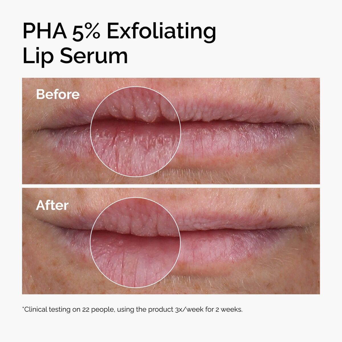 pha-5-exfoliating-lip-serum-g0 ord-pha-5pct-lip-exfoliating-serum-before-after.jpg