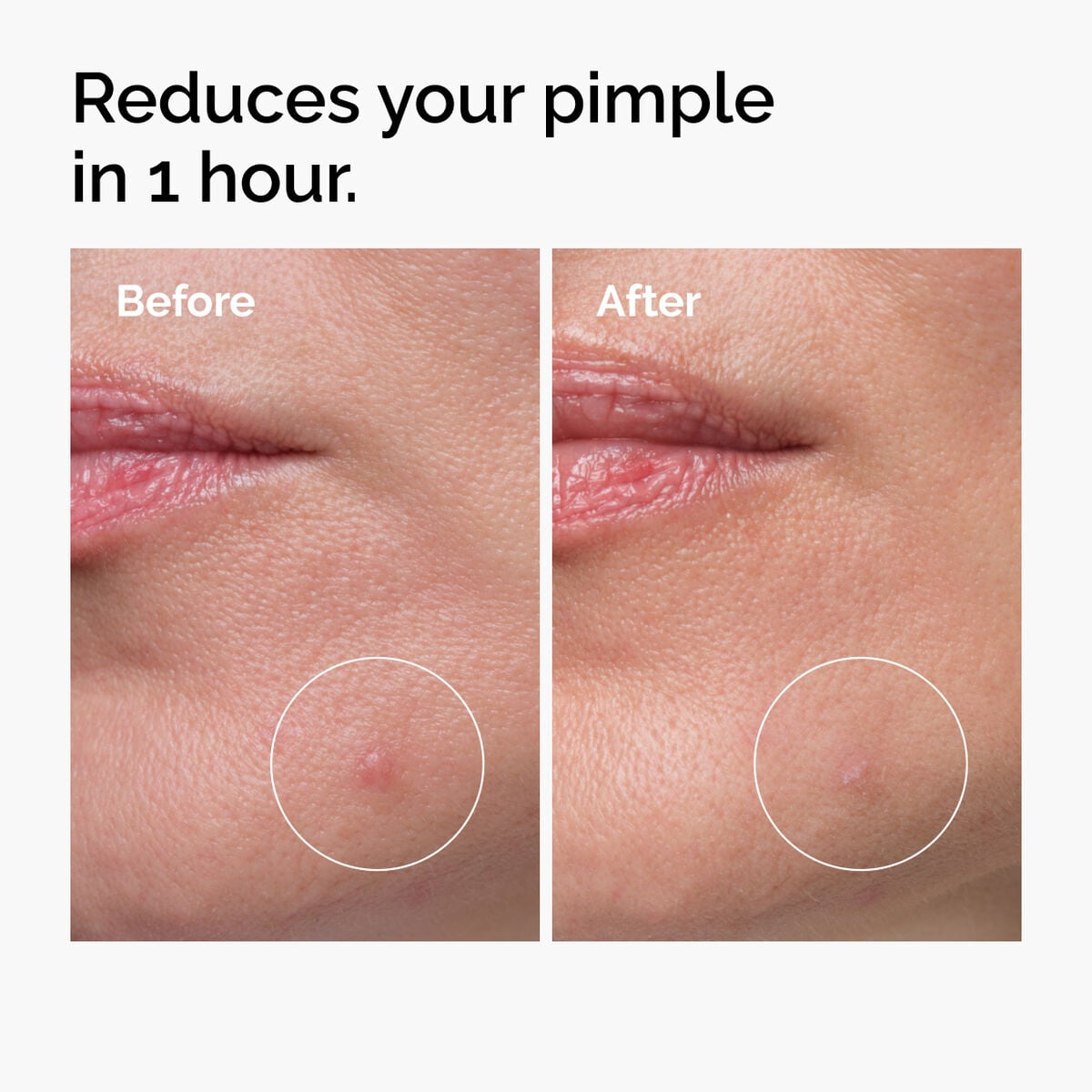 sulfur-10-powder-to-cream-concentrate-r5 ord-sulfur-10pct-powder-to-cream-concentrate-before-after-NA.jpg